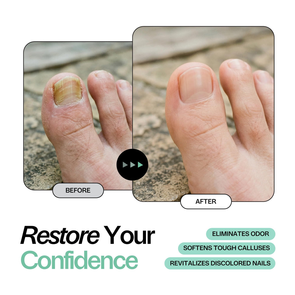 Tea Tree Oil Foot Soak