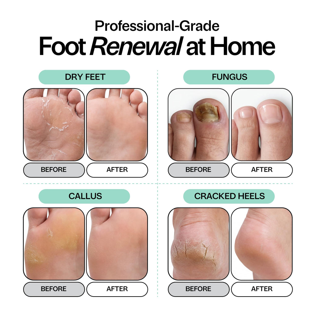 Tea Tree Oil Foot Soak