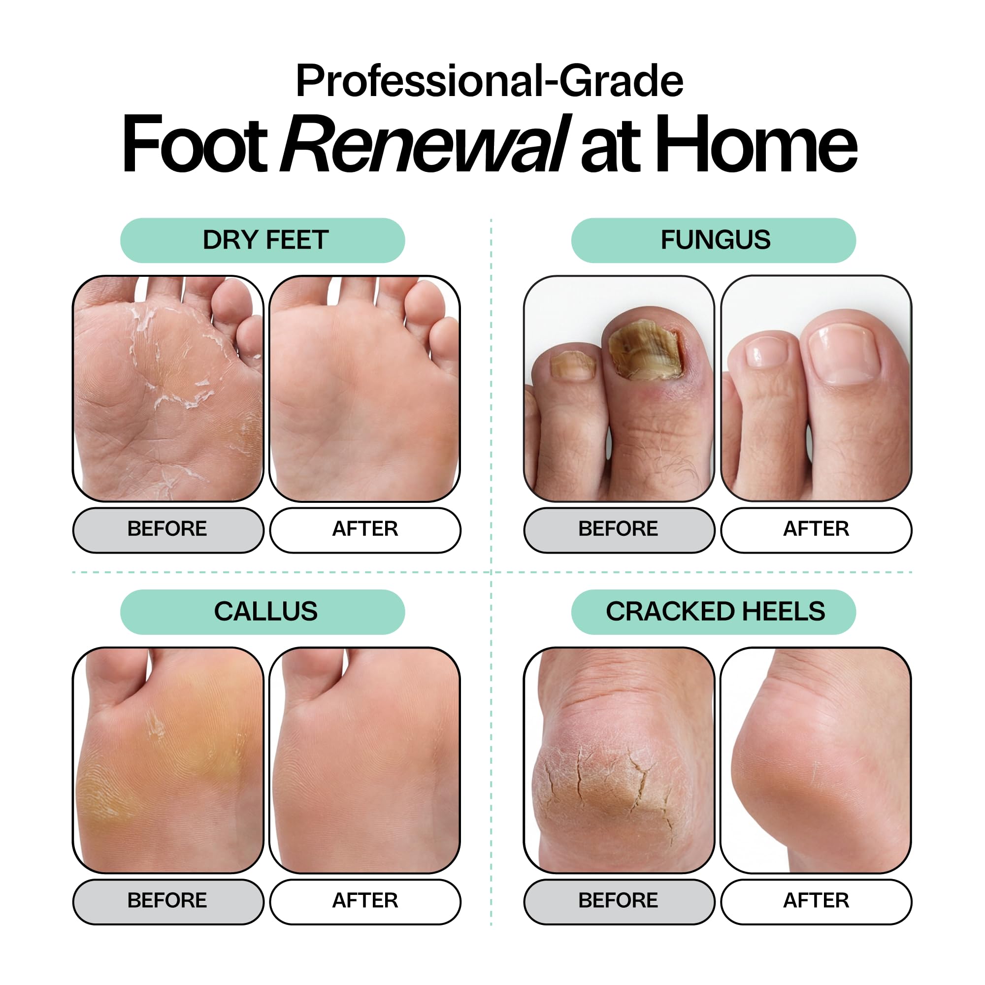 Tea Tree Oil Foot Soak