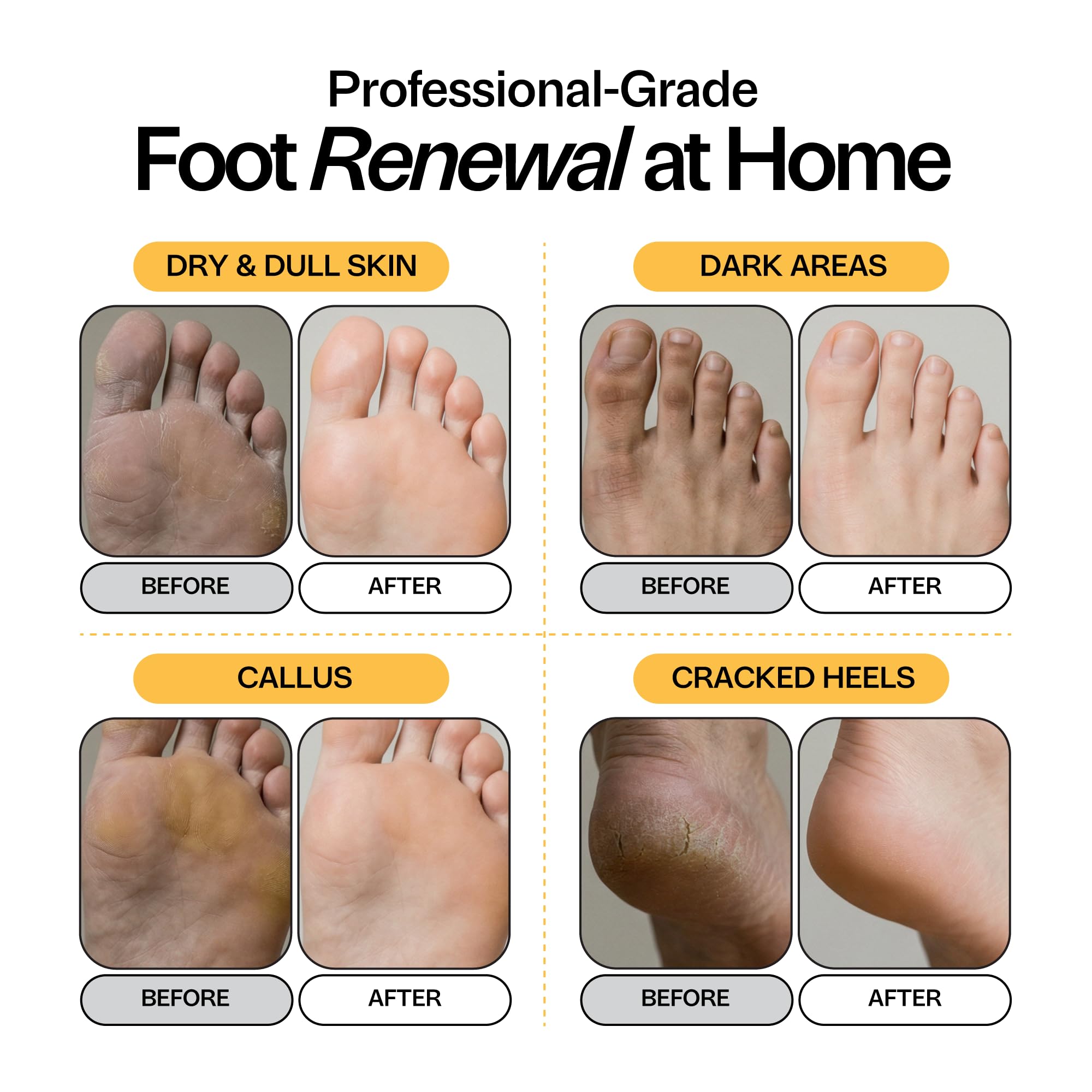 Skin Brightening Foot Soak