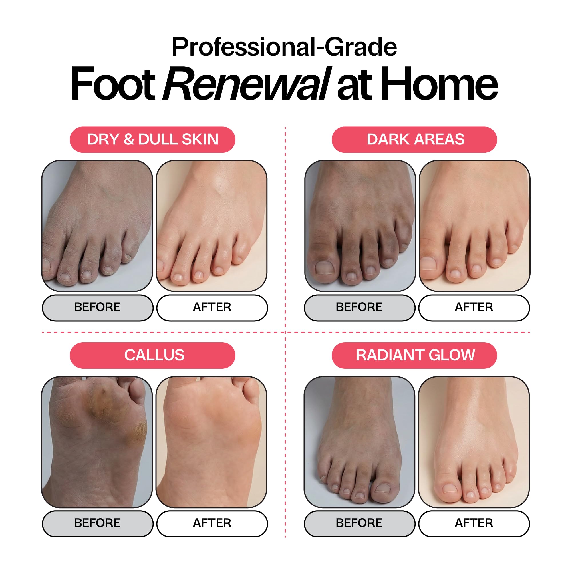 PINK BLOOM FOOT SOAK